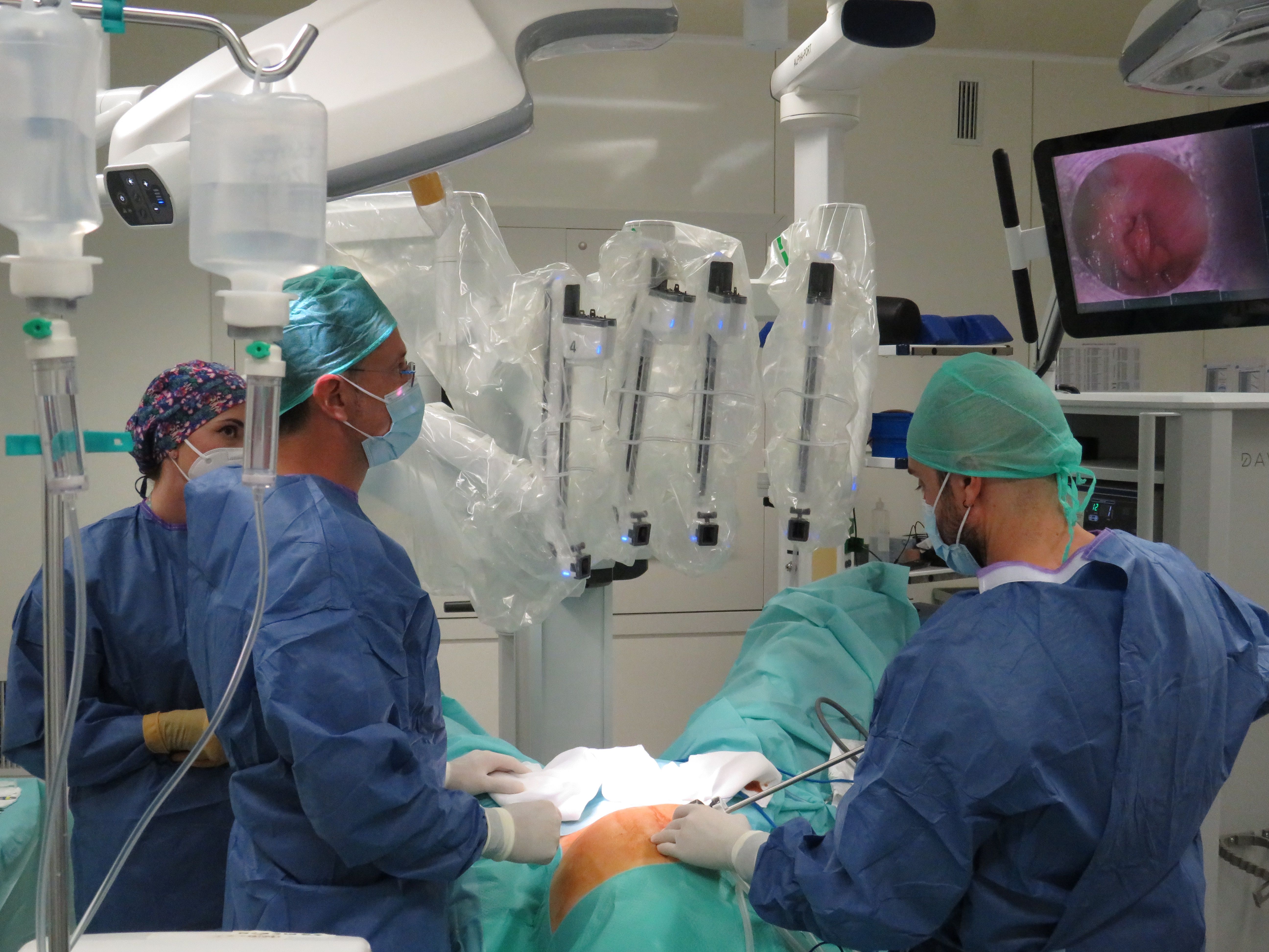 El sistema de ABEX Excelencia Robótica se revela como la plataforma más innovadora en la actualidad para cirugía mínimamente invasiva. | L.N.C.