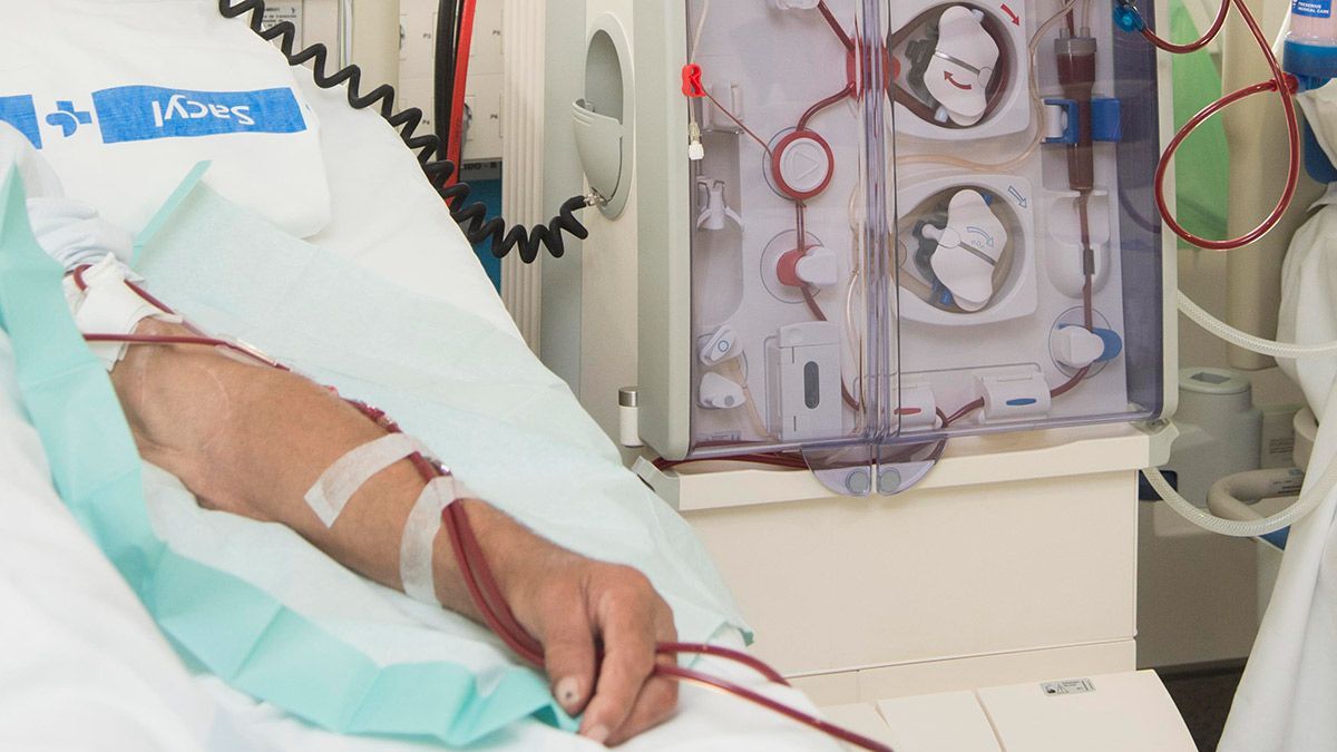 Un paciente de hemodiálisis en un Hospital, en una imagen de archivo. | ICAL